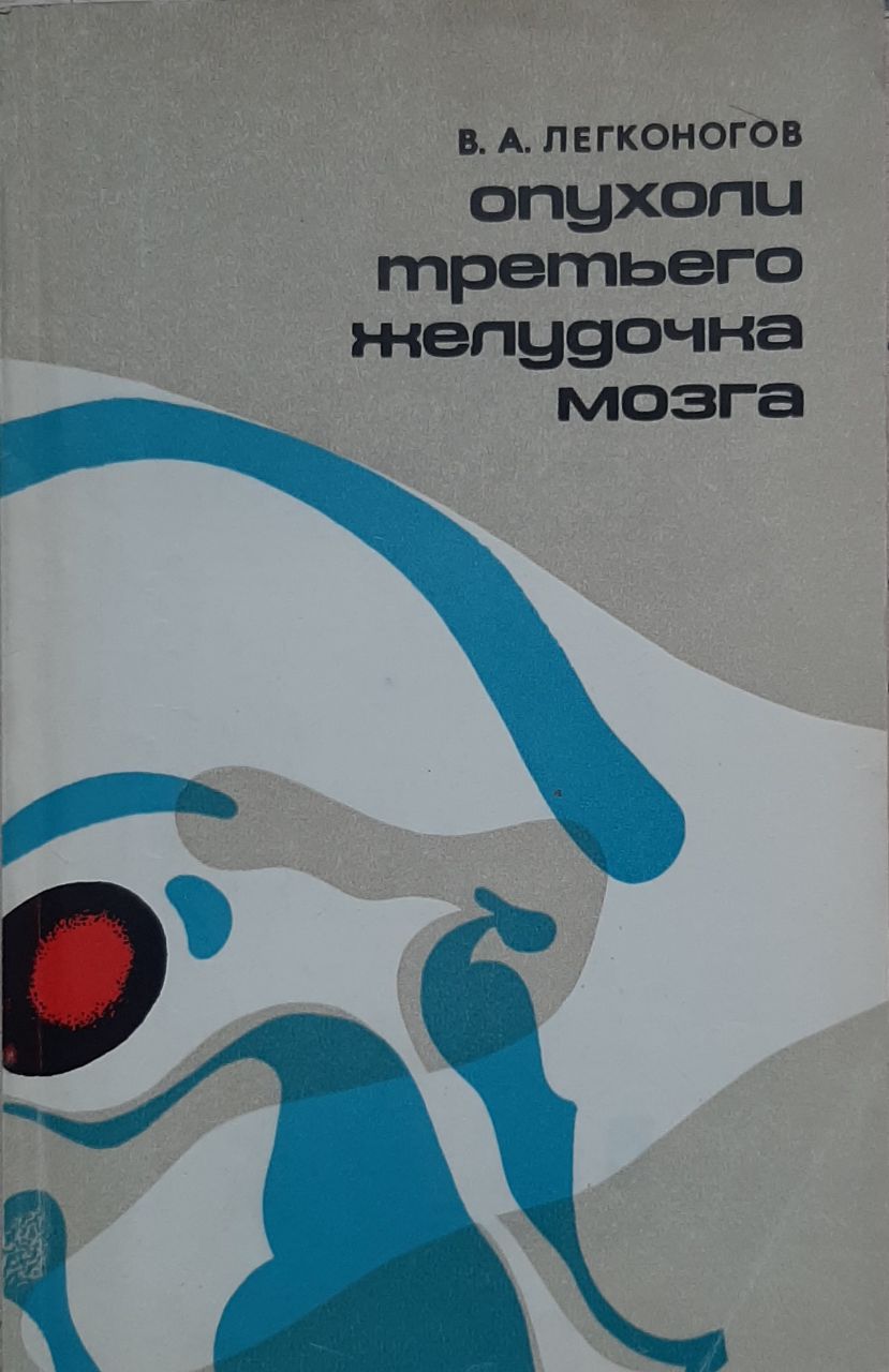 Опухоли третьего желудочка мозга